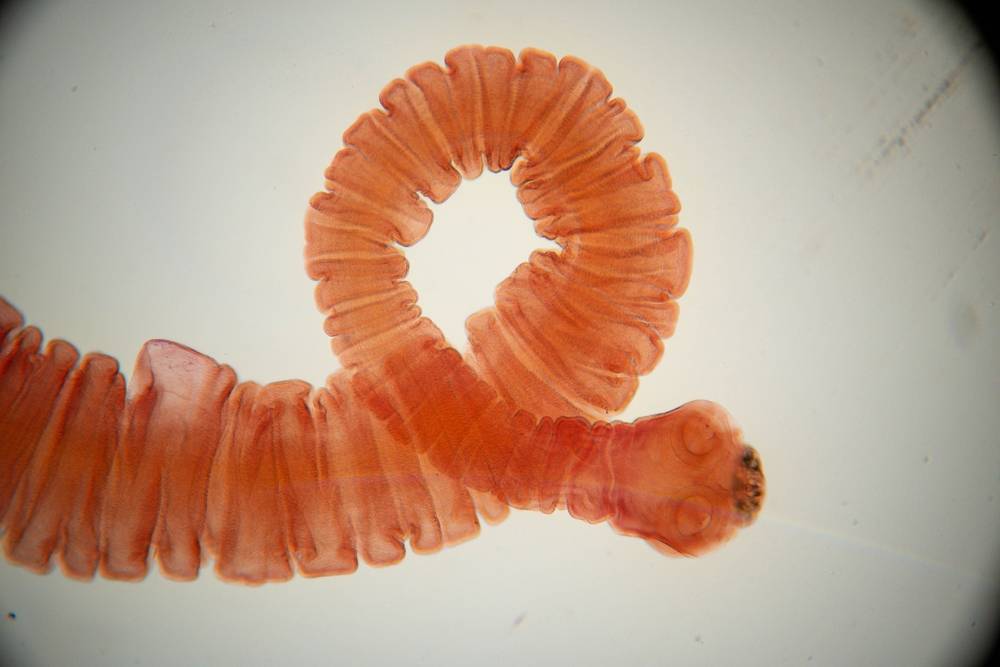 How To Rid Your Body Of Parasites