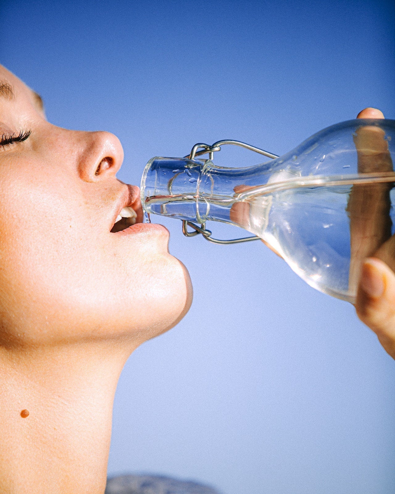 Signs Of Dehydration In Adults